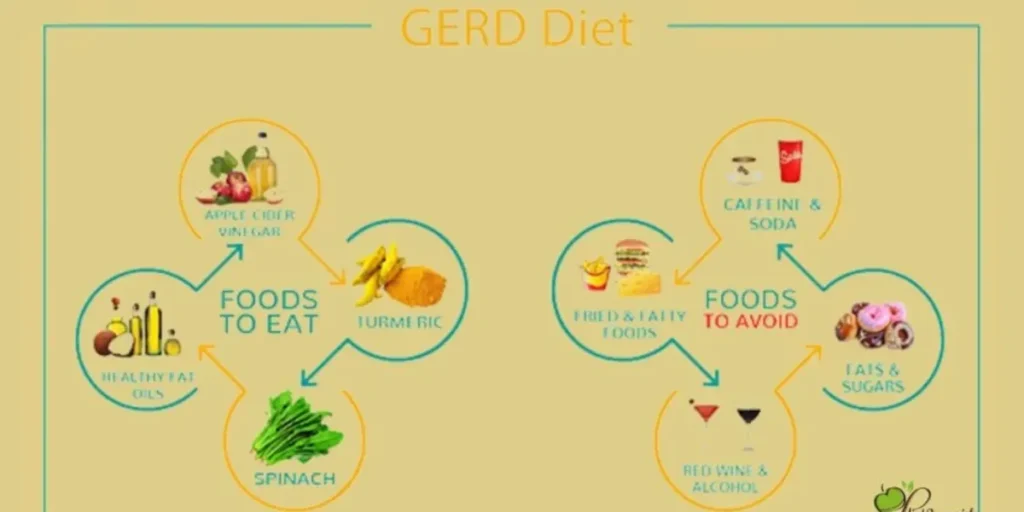 7-Day GERD Diet Plan